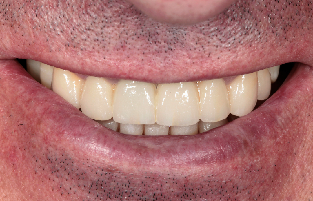 Transformación sonrisa