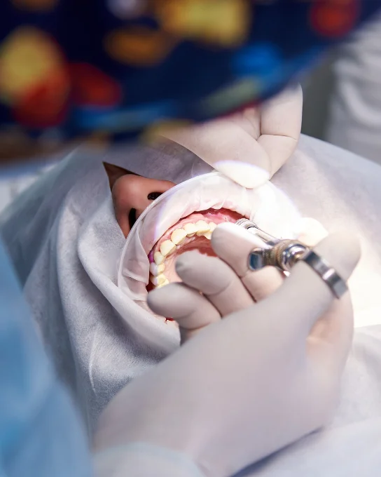 Procedimiento de cirugía guiada dental