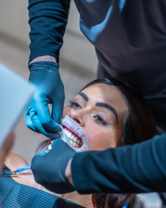 Blanqueamiento dental con luz LED