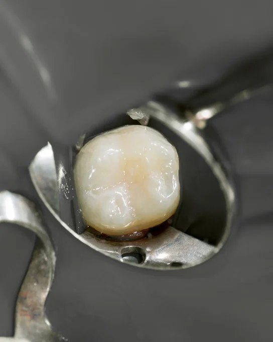 Empastes Dentales