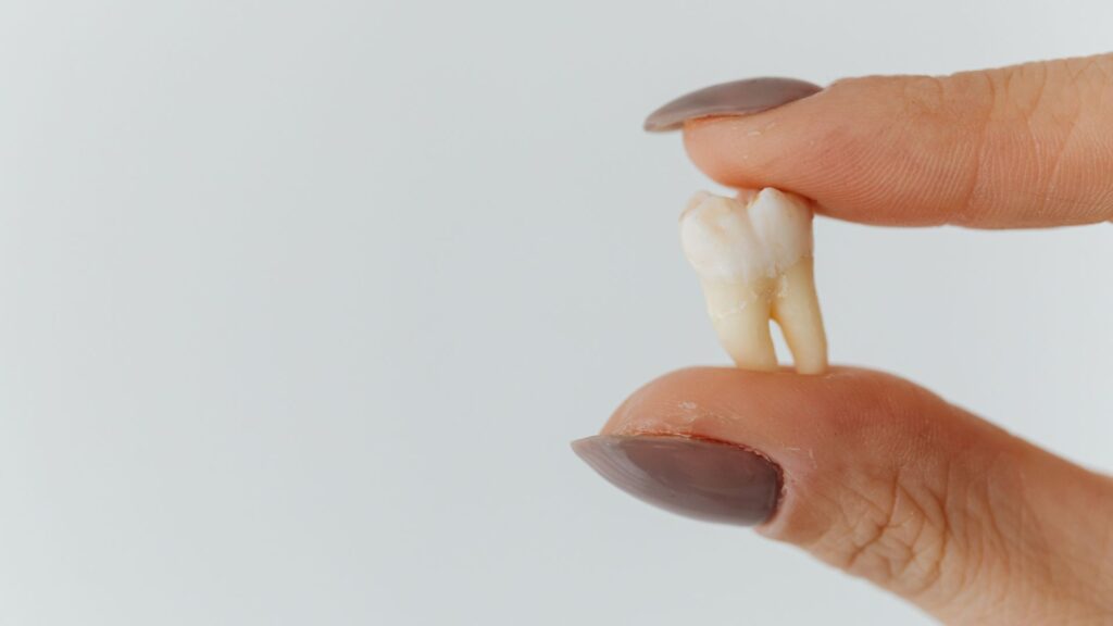 Hipersensibilidad Dental