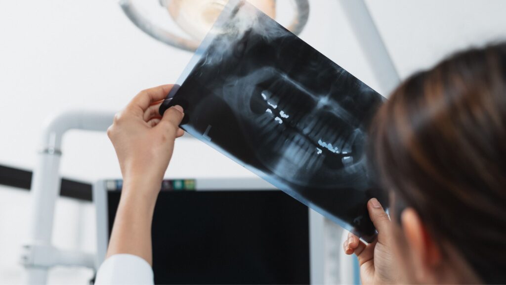 TAC dental